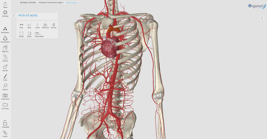 Aortic Dissection