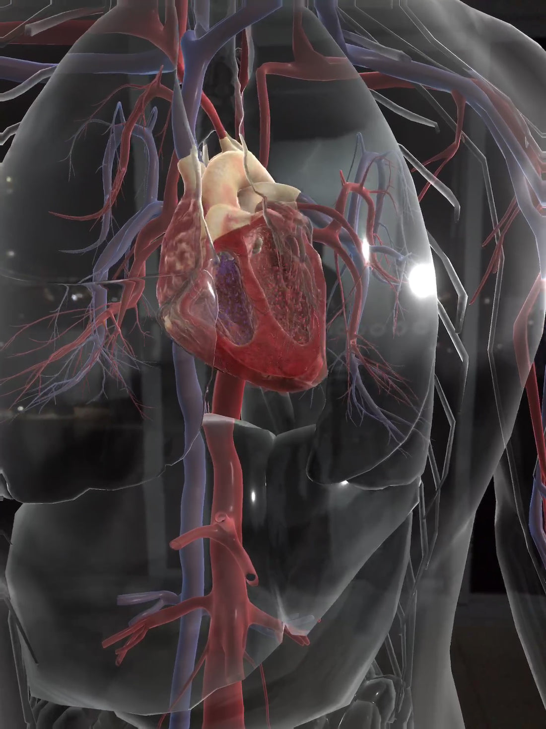 Heart Sounds ? Are they in your arsenal ?